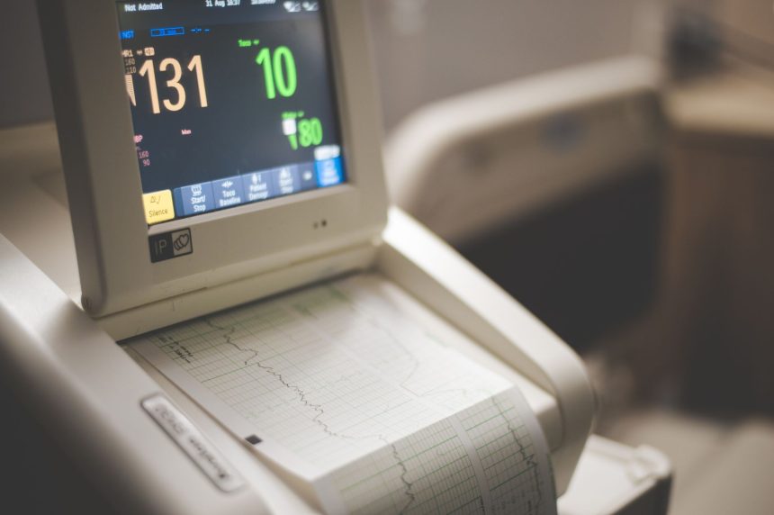 Close de um monitor hospitalar exibindo traçados de eletrocardiograma, frequência cardíaca e níveis de oxigênio.